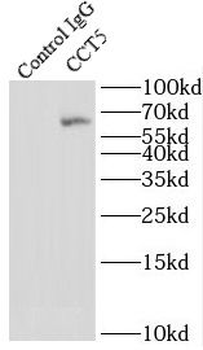 CCT5 Antibody