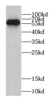 CCT5 Antibody