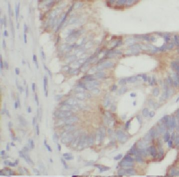 CCT5 Antibody