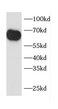 CCT8 Rabbit Polyclonal Antibody