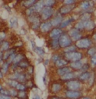 MCAM Mouse Monoclonal Antibody