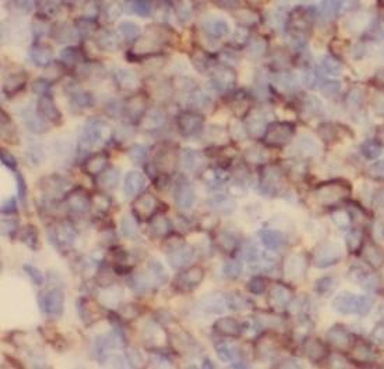 MS4A1 Antibody