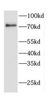 CD2AP Antibody