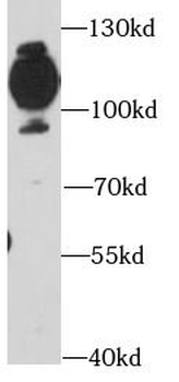 CD36 Antibody