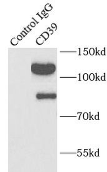 ENTPD1 Antibody