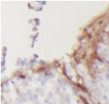 ENTPD1 Antibody