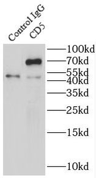 CD5 Rabbit Polyclonal Antibody