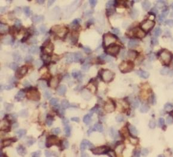 CD5 Rabbit Polyclonal Antibody
