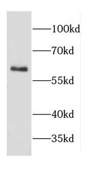 CD69 Antibody