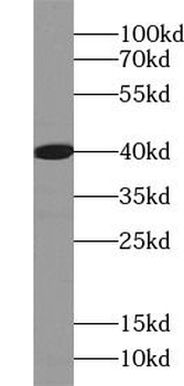 CD79A Rabbit Polyclonal Antibody