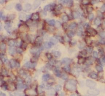 CD79A Rabbit Polyclonal Antibody