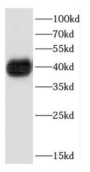CD8B Antibody