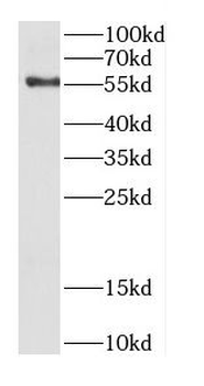 CDC14B Rabbit Polyclonal Antibody