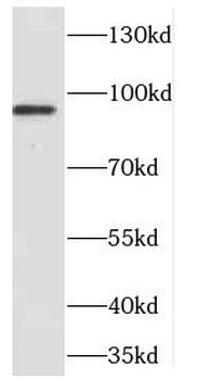 CDC27 Rabbit Polyclonal Antibody