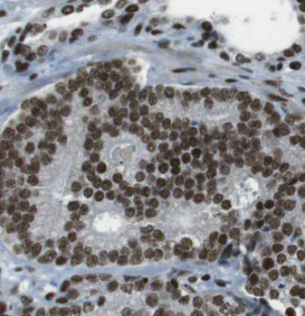 CDC27 Rabbit Polyclonal Antibody