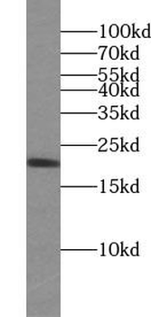 CDC42 Rabbit Polyclonal Antibody