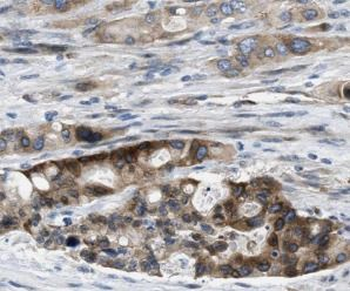 CDC42 Rabbit Polyclonal Antibody