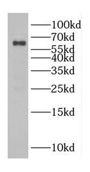 CDC45 Rabbit Polyclonal Antibody