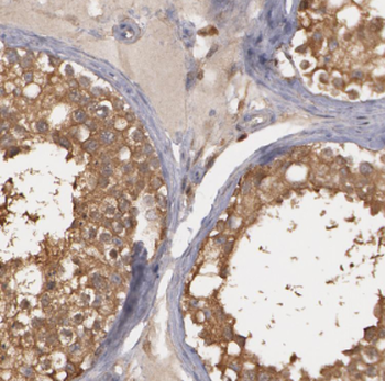 CDC45 Rabbit Polyclonal Antibody