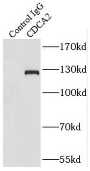 CDCA2 Rabbit Polyclonal Antibody
