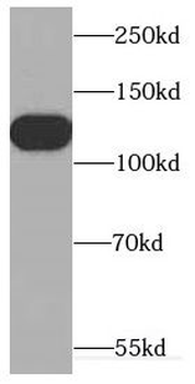 CDCA2 Rabbit Polyclonal Antibody