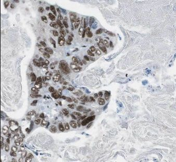 CDCA2 Rabbit Polyclonal Antibody