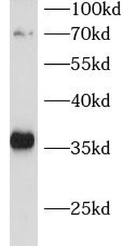 CDCA5 Antibody