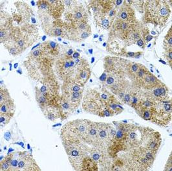 CDH23 Rabbit Polyclonal Antibody