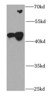 CDK10 Rabbit Polyclonal Antibody