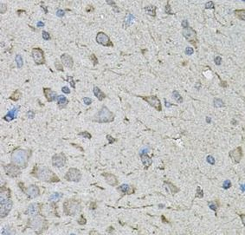 CDK10 Rabbit Polyclonal Antibody