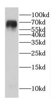 CDK5RAP1 Rabbit Polyclonal Antibody