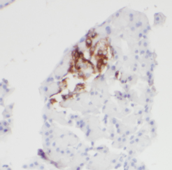 CDK5RAP1 Rabbit Polyclonal Antibody