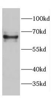 CDK5RAP3 Rabbit Polyclonal Antibody