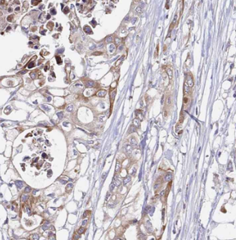 CDK5RAP3 Rabbit Polyclonal Antibody