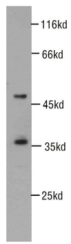CDK6 Antibody