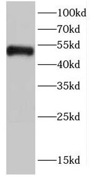 CDK8 Rabbit Polyclonal Antibody
