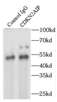 CDKN2AIP Rabbit Polyclonal Antibody