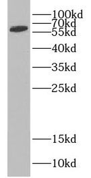 CDKN2AIP Rabbit Polyclonal Antibody