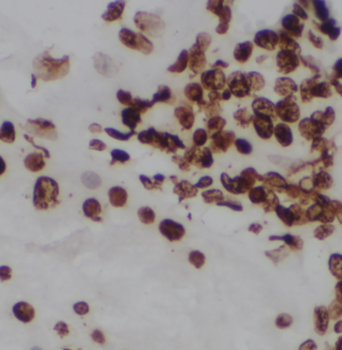 CDKN2AIP Rabbit Polyclonal Antibody