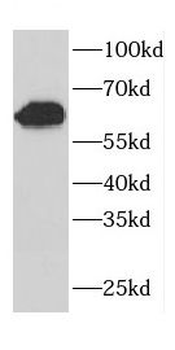 CDR2 Rabbit Polyclonal Antibody