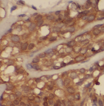 CDR2 Rabbit Polyclonal Antibody