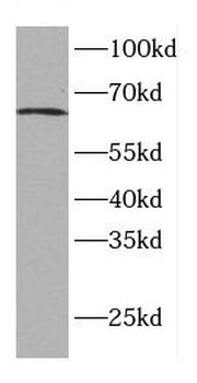 CDT1 Rabbit Polyclonal Antibody