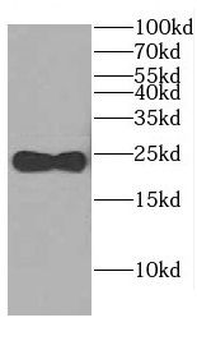 CEND1 Rabbit Polyclonal Antibody