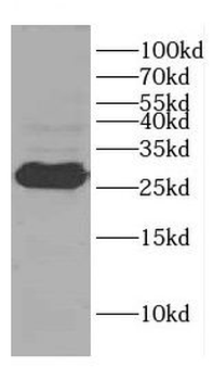 CENPH Rabbit Polyclonal Antibody