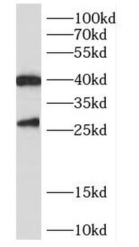 CENPN Rabbit Polyclonal Antibody