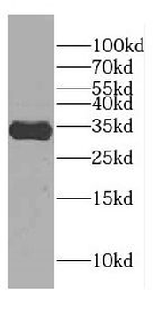 CENPP Rabbit Polyclonal Antibody