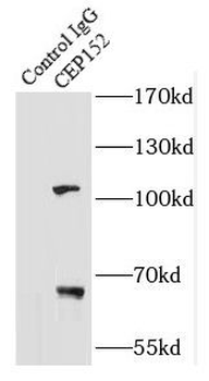 CEP152 Rabbit Polyclonal Antibody