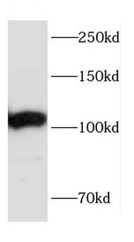 CEP152 Rabbit Polyclonal Antibody