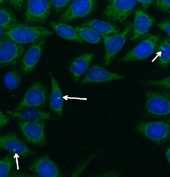 CEP290 Rabbit Polyclonal Antibody