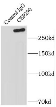 CEP290 Rabbit Polyclonal Antibody
